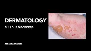 PEMPHIGUS VULGARIS  BULLOUS PEMPHIGOID  بالعربي [upl. by Pudendas946]