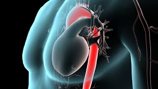 ACLS  ECG rhythm recognition amp management Part 1 [upl. by Doowrehs]