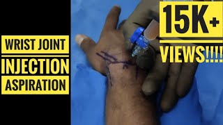 Wrist InjectionAspiration Technique [upl. by Nerrat]