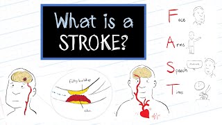 What is a Stroke HealthSketch [upl. by Ailisec]