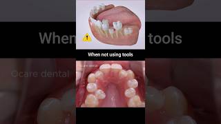 Why are your teeth crooked Maybe this is problem dentist dentist teeth braces [upl. by Leisha]