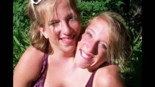 Lovely conjoined Minnesota twins Abigail and Brittany [upl. by Notniw]