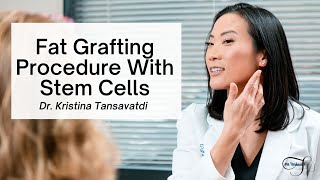 Fat Grafting Procedure with Stem Cells Explained by Dr Tansavatdi [upl. by Enilehcim]