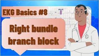 ECG basics  right bundle branch block RBBB  ECG findings and examples clinical significance [upl. by Liagabba676]