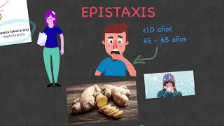 Epistaxis  Sangrado nasal Etiología diagnóstico y tratamiento [upl. by Rourke]