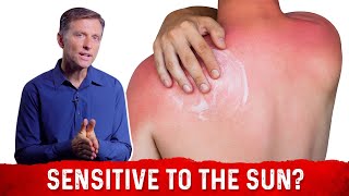 Can You Be Allergic to the Sun – DrBerg on Sun Allergy and Niacin Deficiency [upl. by Fugate]