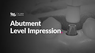 Abutment Level Impression [upl. by Helm423]