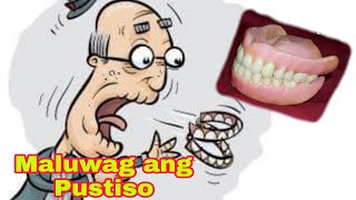 Solution At Remedy Maluwag na Pustiso Loose Dentures Ano ang Dapat Gawin kapag Maluwag ang Pustiso [upl. by Ruperta]