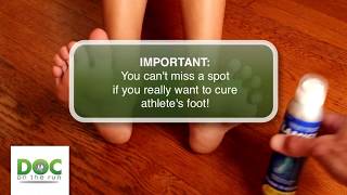 How to treat the foot fungus with topical antifungal [upl. by Etteinotna]