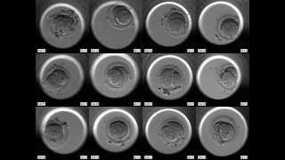 Embryoscope  Embryonen Entwicklung online [upl. by Imre]