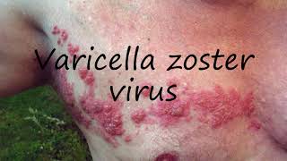 How to Pronounce Varicella zoster virus [upl. by Annekcm]