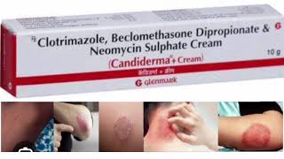 Candiderma  Cream Clotrimazole Beclomethasone Dipropionate amp GNeomycin Sulphate Cream [upl. by Ennis]