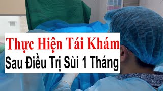 Thực Hiện Tái Khám Sau 1 Tháng Điều Trị Sùi Mào Gà Hiệu Quả Tại Bác Sĩ Sắc Bv Việt Đức [upl. by Ajnos967]