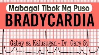 Bradycardia Slow Heart Rate  Dr Gary Sy [upl. by Debby625]