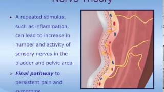 Understanding Interstitial Cystitis ICPainful Bladder Syndrome PBS [upl. by Chari]