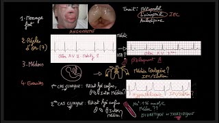 Traitement de lhypertension artérielle  Guidelines  Exercices  HTA  Docteur Synapse [upl. by Ashbaugh961]