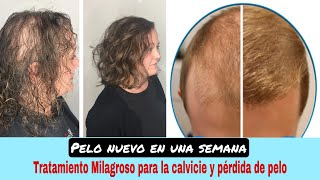 Esta mezcla RECUPERARÁ el cabello que perdiste😭 Cabello fino Calvicie y Crecimiento GARANTIZADO❗️ [upl. by Yrolam]