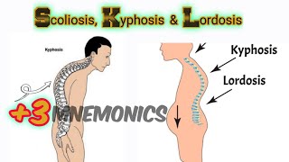 Lordosis Kyphosis and Scoliosis [upl. by Leirad]