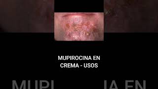 MUPIROCINA EN CREMA  USOS [upl. by Albertine]