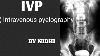 IVP  Intravenous pyelography  procedure in hindi  IVP Procedure [upl. by Leede]