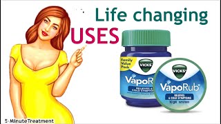 Vicks VapoRub  Top 9 Alternative Uses for Vicks VapoRub  5Minute Treatment [upl. by Bacchus270]