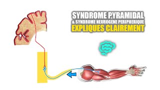 🔴 Syndrome pyramidal VS syndrome neurogène peripherique Expliqués Très Clairement par Dr Astuce [upl. by Esilehc467]