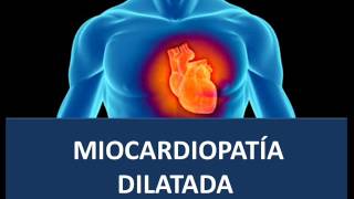 Miocardiopatía dilatada  Fisiopatología [upl. by Woods]