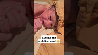 Cutting the umbilical cord 🤱👼🍼  breastfeeding cute baby babygirl cutebaby [upl. by Herwin301]