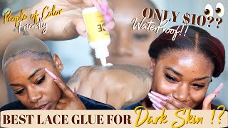 This 10 LACE GLUE IS THE TRUTH  POC amp DARK SKIN FRIENDLY  Laurasia Andrea My First Wig [upl. by Erastus]