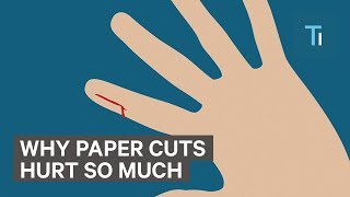 Why Paper Cuts Hurts So Much [upl. by Una]