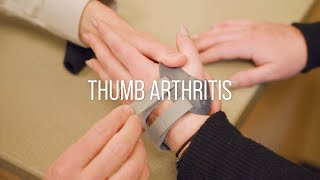 Thumb Arthritis Symptoms Causes and Treatment [upl. by Blackmun]