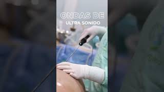 ¿LIPOSUCCIÓN CON LÁSER Vaser Ultraz Jplasma Microair ¡Conócelos  Dra Patricia Betancourt [upl. by Richmal]