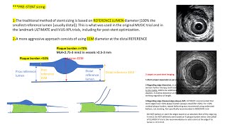 IVUSOCT stent guidance pre and poststenting [upl. by Lon]