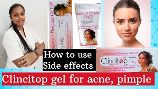 Clincitop gel l clindamycin gel l acne pimple काळे डाग घालवण्यासाठी best gel l Rohini pharmacist l [upl. by Aihsenot]