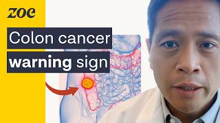 Harvard Doctor Why young people are getting colon cancer  Dr Andy Chan [upl. by Krispin]