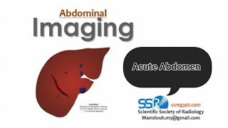 Imaging of acute abdomen  Prof Mamdouh Mahfouz [upl. by Cirtap]