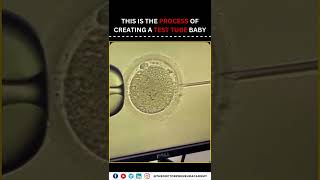 IVF A Journey to Parenthood Through Advanced Fertility Solutions [upl. by Serdna]