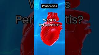 What Is Pericarditis [upl. by Anerual]