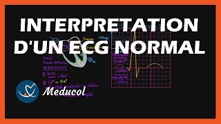 Electrocardiogramme ECG  interpretation dun ECG normal [upl. by Halilad]