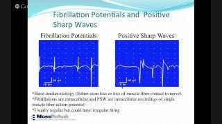 Intro to Electrodiagnostic Studies [upl. by Yeldud94]