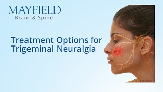 Facial Pain Treatment Treatment Options for Trigeminal Neuralgia [upl. by Doak]