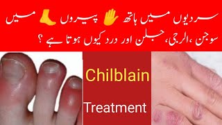 Treatment of Chilblains swellingpain  Allergies redness [upl. by Ahsitak]