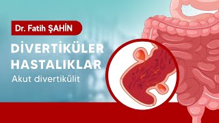 DİVERTİKÜLER HASTALIKLAR  Dr Fatih Şahin Anlatıyor [upl. by Anitserp767]