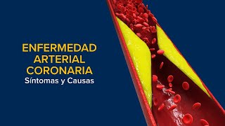 Enfermedad Arterial Coronaria EAC Síntomas y causas [upl. by Halyk]