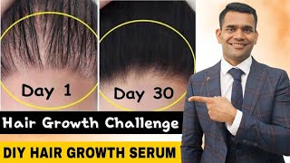 Powerful Hair Growth Serum For Extreme Hair Growth  Regrow Lost Hair Get Double Density in 30 days [upl. by Krebs]