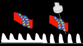 Umbilical Artery Doppler interpretation [upl. by Yahc]