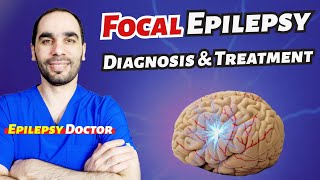 Focal or Partial Epilepsy Diagnosis and Treatment [upl. by Ynneb]