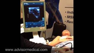 Ultrasound Guided Hip Injection [upl. by Otero]