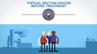 Rectum Spacer in Radiotherapy for Prostate Cancer [upl. by Howard]