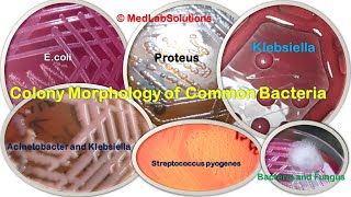 Various Common Bacteria Colony morphology E coli Klebsiella Staphylococcus Pseudomonas and More [upl. by Latsyc483]